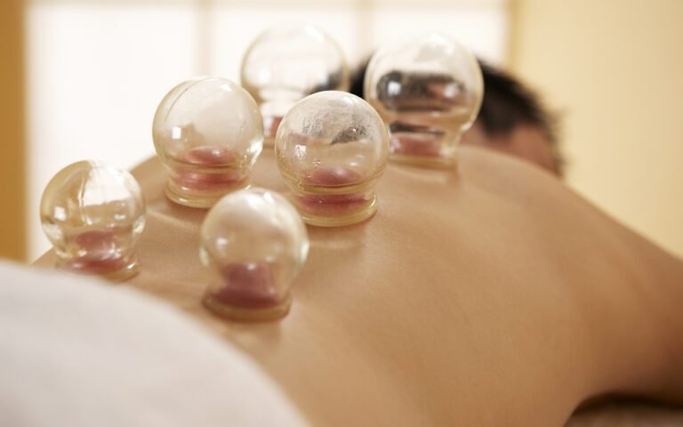 Best Silicone Cupping Sets for Deep Tissue Work 1