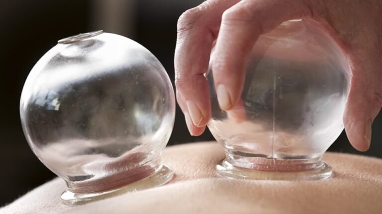 Cupping Therapy for Athletes Real World Performance Benefits